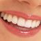 Sbiancamento denti: come funziona