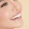 Sbiancamento denti domiciliare