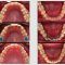 Apparecchio denti Valsamoggia e ortodonzia adulti e bambini