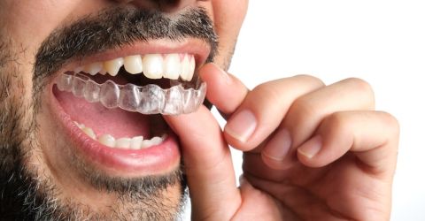 Ortodonzia adulti Valsamoggia: soluzioni moderne per un sorriso armonico